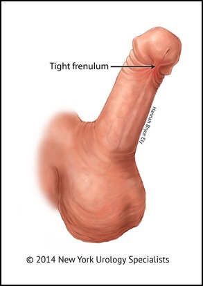 frein penis